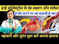 हाई कोलेस्ट्रॉल के 10 लक्षण और संकेत || 10 Signs Of High Cholesterol | Bad cholesterol Signs On Face