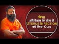 बिना ऑपरेशन (Operation) के योग से Uterus Infection को किया Cure || Swami Ramdev
