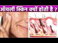 ऑयली स्किन क्यों होती है , Skin Par Oil Kyu Ata Hai |Boldsky*Health