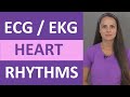 EKG Rhythms | ECG Heart Rhythms Explained - Comprehensive NCLEX Review
