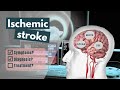 Ischemic Stroke Animation | Symptoms, diagnosis, treatment \u0026 prognosis