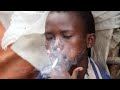 🇱🇷🥲 Kush - The drug Killing Liberian Youth 🥲🇱🇷 #Liberia #African