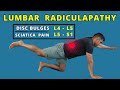 Lumbar Radiculopathy L4 L5 - L5 S1 exercises for pain relief