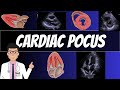 CARDIAC POINT OF CARE ULTRASOUND (POCUS)