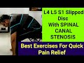 L4 L5 S1 Slipped Disc With SPINAL CANAL STENOSIS Treatment -Best Exercises For Spinal Canal Stenosis
