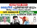 മരുന്നില്ലാതെ തന്നെ മൈഗ്രീൻ പൂർണമായി മാറ്റാം അതും ഒരൊറ്റ ദിവസം കൊണ്ട് | migraine headache relief