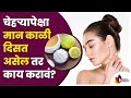चेहऱ्यापेक्षा मान काळी दिसत असेल तर काय करावं? Remove tan on the neck | Best Home Remedies