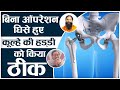 बिना ऑपरेशन घिसे हुए कूल्हे की हड्‌डी को किया ठीक  || Swami Ramdev