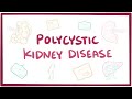 Polycystic kidney disease - causes, symptoms, diagnosis, treatment, pathology