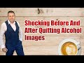 Shocking Before And After Quitting Alcohol Images