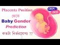 প্লাসেন্টা থেকে বেবী জেন্ডার নির্ধারণ | Placenta Position and Baby Gender | The Bong Parenting