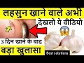 इस तरह लहसुन खाओगे तो मरते दम तक बीमार नहीं पड़ोगे, Garlic Benefits For Health