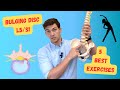 Bulging Disc L5/S1: The 5 Best Exercises (Explained in Detail)