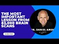 The most important lesson from 83,000 brain scans DR. Daniel Amen
