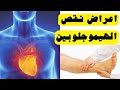 اعراض نقص الهيموجلوبين