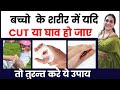 बच्चों के शरीर में  कोई कट या घाव हो जाए तो तुरंत करें ये उपाय/First aid in minor cuts or injuries