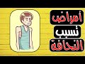 لماذا لا يزيد وزنك؟ 5 أمراض خطيرة قد تكون السبب وراء النحافة ⚠️🔍