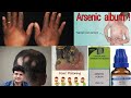 Homeopathic Medicine Arsenicum Album ! Uses ! Disease ! Symptom ! Doses ! experience !