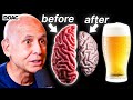 The Ugly Truth About Alcohol’s Effect On Your Brain. | Dr Daniel Amen