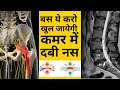 बस ये करो ठीक हो जाएगी कमर में दबी नस | L4-L5 disc Bulge | SCIATICA | DABI NAS | leg pain | Hip pain