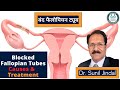 Blocked Fallopian Tubes