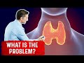 Hypothyroidism May Not Be a Thyroid Problem But Hashimoto Thyroiditis – Dr. Berg
