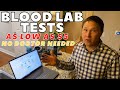 Best Cheap Online Blood Lab Tests No Doctor Needed for Not Insured Vegans