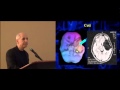 Dr. Daniel Amen | Brain SPECT Imaging - Psychiatry's Tool to Save Lives