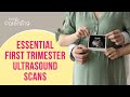 Essential Pregnancy First Trimester Scans That You Must Aware Of | First Trimester Ultrasound