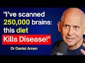 The Brain Doctor: 5 FOODS You MUST EAT! Dr Daniel Amen
