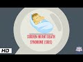 Sudden Infant Death syndrome, Causes and Prevention