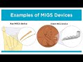 Innovations in Glaucoma Treatment: MIGS