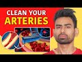 How to Unclog Your Arteries (\u0026 Prevent Heart Attack)