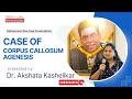 Case of Corpus CallosumAgenesis | Dr. Akshata Kashelikar | HahnemannDay2024 | Predictive Homoeopathy