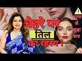 शरीर के अंगों के तिल क्या दर्शाते है ? Mole on body reveal about your behaviour 