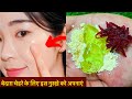 बेसन के इस्तेमाल से चेहरा इतना गोरा ख़ूबसूरत कर देगा ये नुस्ख़ा Skin Whitening