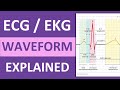 ECG Waveform Explained and Labeled | ECG Interpretation Nursing NCLEX