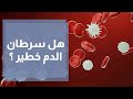 هل سرطان الدم خطير ؟ وهل يمكن الشفاء منه؟