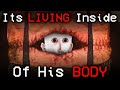 The PARASITE Torturing Him From The INSIDE | Doctor Nowhere