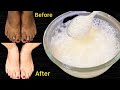 हाथ पैर गर्दन पर सालों से जमी मैल गंदगी बदबू मिनटों में साफ़ कर गोरा बना देगा ये नुस्ख़ा