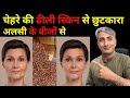 ढीली लटकी बेजान स्किन में डालें एक नयी जान । स्किन टाइट करने के उपाय I DR. MANOJ DAS