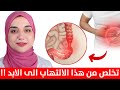 علاج القولون العصبي الهضمي و النفسي نهائيا بدون أدوية/هذه الطريقة ستريحك من آلام القولون للأبد