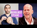 Bruce Willis' Aphasia Explained by A Neurologist