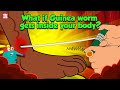 Deadliest Parasite | What if Guinea Worm Gets Inside Your Body? | Dracunculiasis | Dr Binocs Show