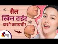 स्किन टाईटनिंग कशी करायची | Skin Tightening Home Remedies | Lokmat Sakhi