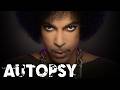 Investigating Prince's Untimely Death: The Shocking Truth | Our History