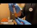 Should You Take A Coronavirus Antibody Test? What You Need To Know | TODAY