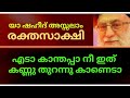 എടാ കാന്തപ്പാ നീ ഇത്  കണ്ണു തുറന്നു കാണെടാ☝️രക്തസാക്ഷി അലി ഖമയ്നി😔യാ ഷഹീദ് അസ്സലാം💕