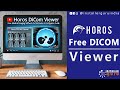Horos DICOM Viewer: Free Medical Imaging Software for macOS - Installation \u0026 Configuration Guide
