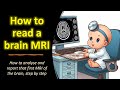 How to read an MRI of the brain?